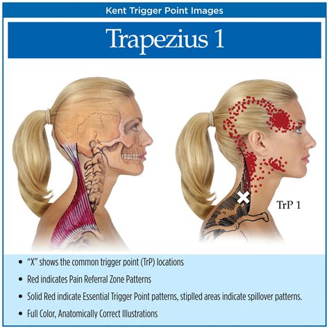 After that, you can change the diagram's size and shape, and enter the text. Trigger Point Charts (5 Chart Set) - Kent Health Systems