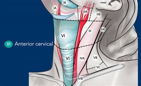 The Radiology Assistant Cervical Lymph Node Map 2023