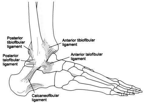 The patellar tendon on the front of the knee is part of the quadriceps mechanism. High Ankle Sprains - Yakima Foot & Ankle