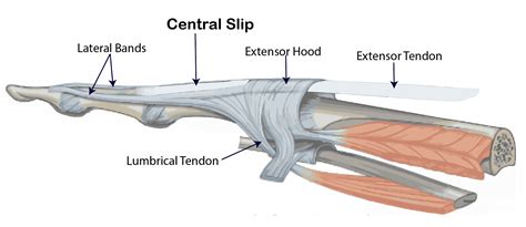 Central Slip Injuries Lothian Virtual Hand Clinic