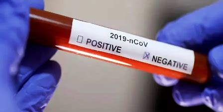 Number of covid deaths claimed by them in the period is a fraction of excess deaths and this is not even the largest state population wise. U/E/R: First COVID-19 Patient Tests Negative; Ready To Be ...