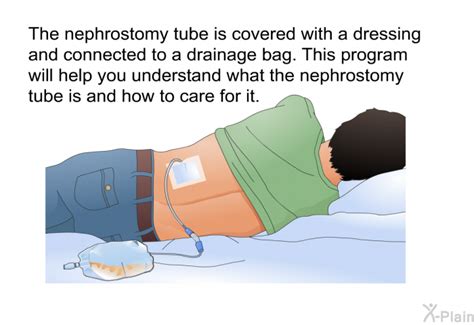 Nephrostomy Tube Care