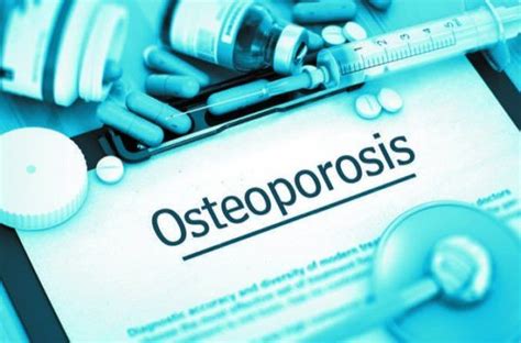 Osteoporosis Drugs Sorting Out The Options Arthritis Advisor