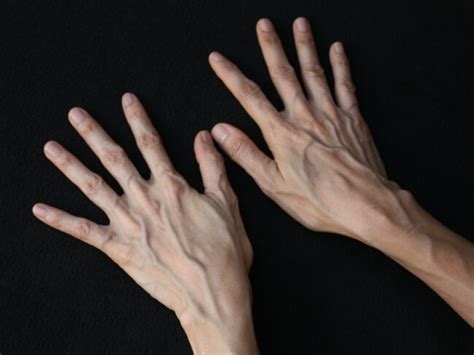 Cara Melemaskan Otot Tangan Yang Kaku Ahmad Marogi