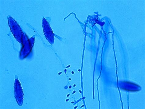 Fun With Microbiology Whats Buggin You Microsporum Gypseum