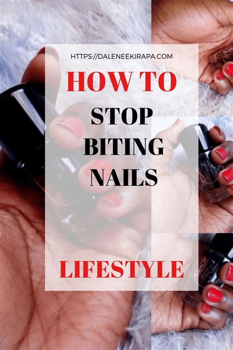 How To Stop Biting Nails Dalene Ekirapa Nail Biting How To Do