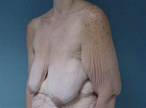 Older Grannies And Matures Showing Their Wrinkled Bodies Porn Pictures