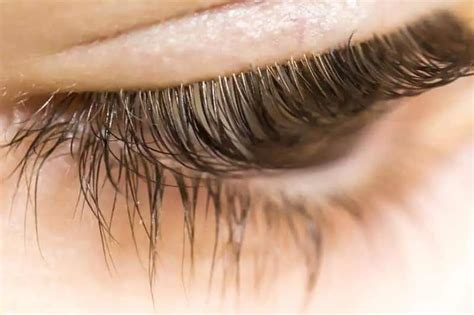 Eyelash Mites Causes Symptoms In Humans Pictures Mascara Eyebrow