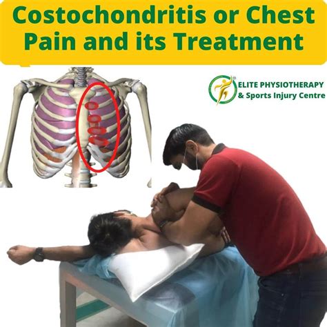 Costochondritis Or Chest Pain And Its Treatment Elite Physio