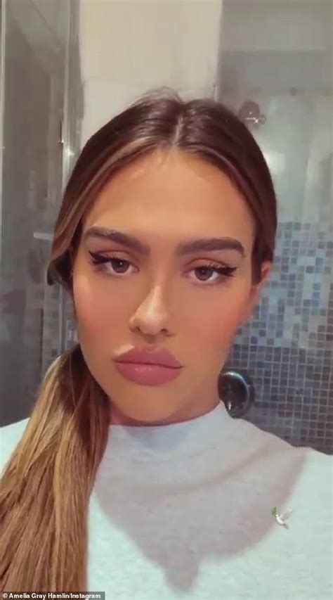 Amelia Hamlin Shares Very Pouty Selfie After Showing Bruised Lips In