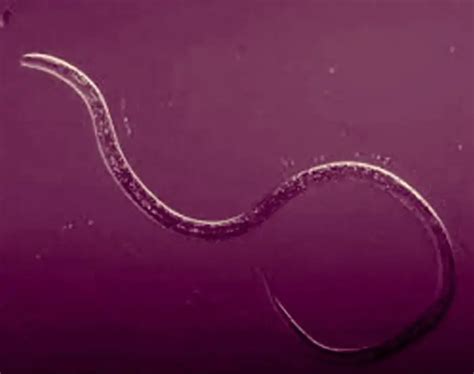 Do Roundworms Have A Body Cavity And What Kind Science 2023