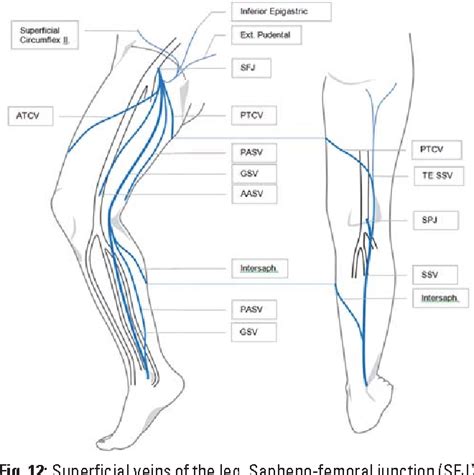 Figure 3 From Duplex Ultrasound In The Assessment Of Lower Extremity