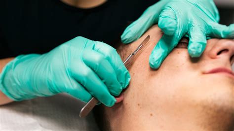 So how is dermaplaning done at home? At Home Dermaplaning - Beauty Photos, Trends & News | Allure
