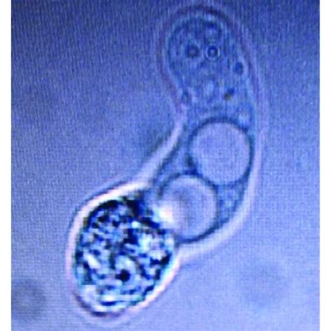 Csf Normal Saline Mount Showing Naegleria Fowleri With Characteristic