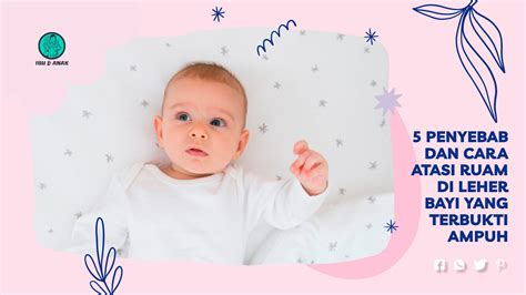 5 Penyebab Dan Cara Atasi Ruam Di Leher Bayi Yang Terbukti Ampuh Mamwips
