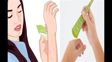 How To Get Rid Of Bumps On Arms With Alovera 7 Effective Remedies Youtube