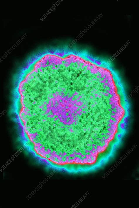 Mumps Virus Tem Stock Image C0435020 Science Photo Library