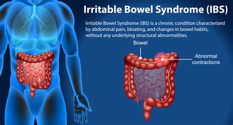 Irritable Bowel Syndrome Ibs Causes Symptoms And Management