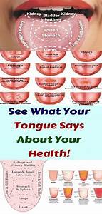 What Your Tongue Is Trying To Tell You About Your Health Tongue