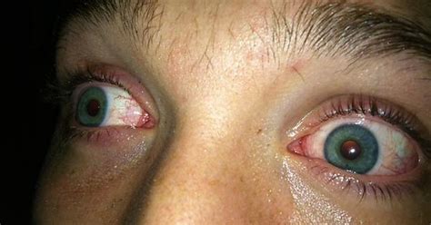 My Friends Eyes Get So Messed Up Imgur