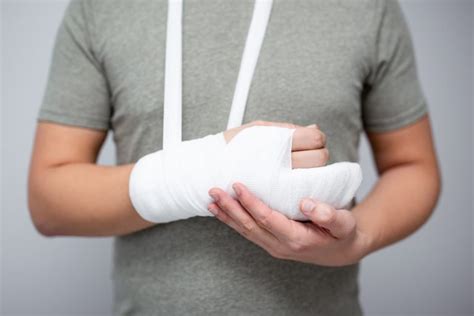 Fractures Broken Bones 101 Types Causes And Treatment Homage