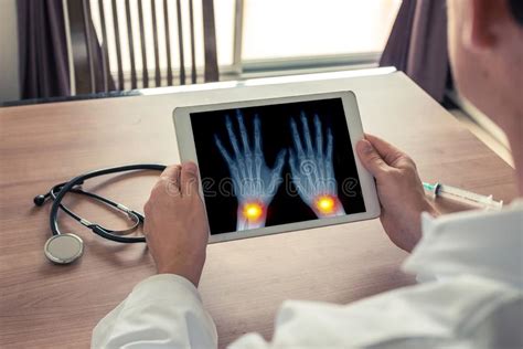 Doctor Que Sostiene Una Tableta Digital Con Dolor En Las Mu Ecas