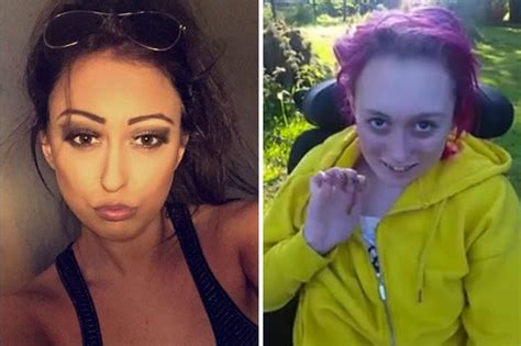 Teenager Left Brain Damaged After Taking Mdma Posts Shocking Video