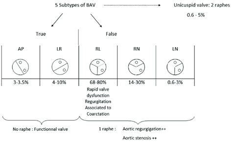 Bicuspid Aortic Valve Subtypes Anatomy And Distribution Download Scientific Diagram