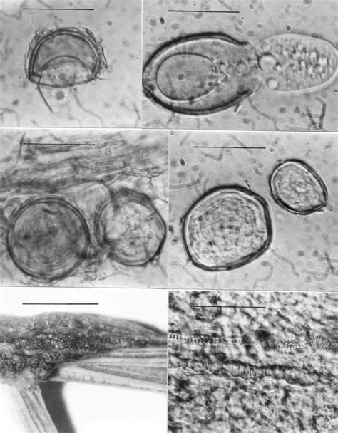 Protomyces Macrosporus Unger Within Leaves And Stems Of Carum Carvi L