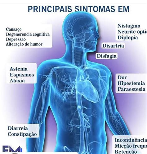 Esclerose Sistemica Tempo De Vida