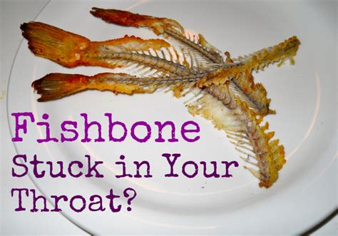 How To Remove A Fish Bone Stuck In Throat Hubpages