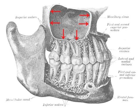 Maxillary Sinus And Molar Roots Relationship