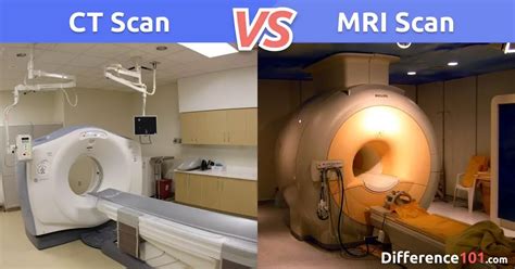 What Is The Difference Between A Ct Scan And An Mri Infouruacth