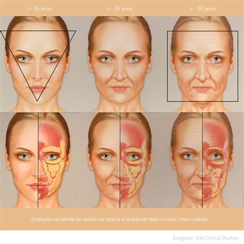 Compartimento De Gordura Da Face