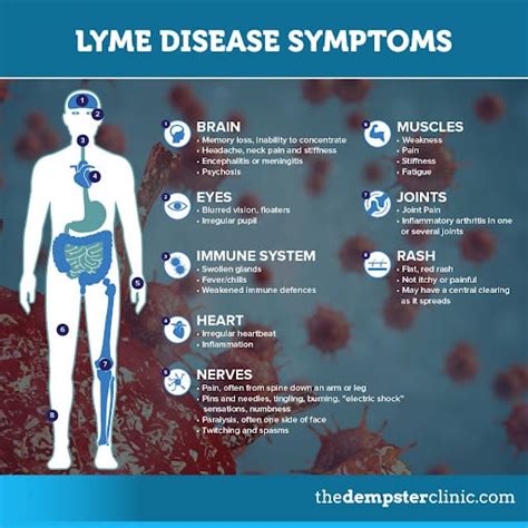Is Chronic Lyme Disease Real The Dempster Clinic