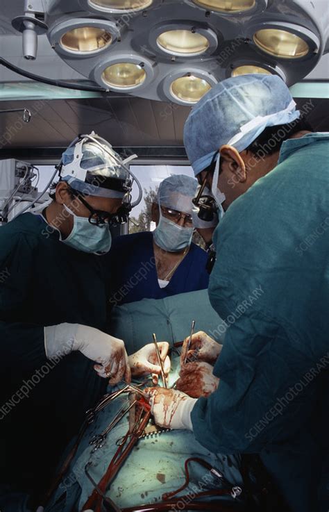 Open Heart Surgery Stock Image M5600437 Science Photo Library