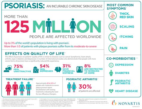 All About Psoriasis An Infographic