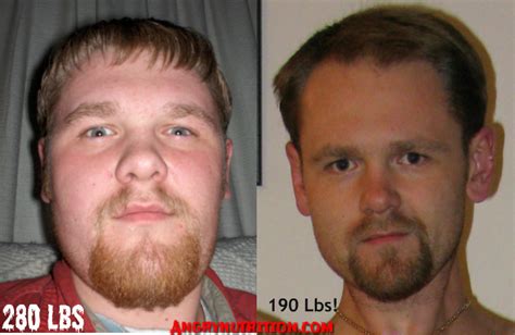 Check spelling or type a new query. What ~100lbs of weight loss looks like in the face : keto