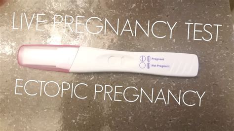 Live Pregnancy Test Ectopic Pregnancy Youtube