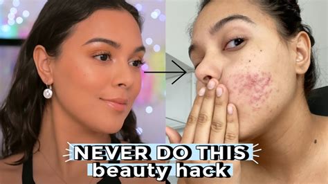 I Ruined My Face With This Beauty Hack Never Do This Youtube