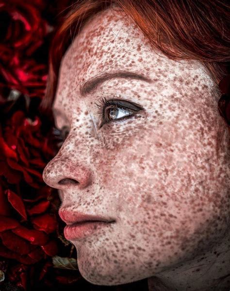 Pin By Lo On Round Beautiful Beautiful Freckles Freckles Girl Freckles