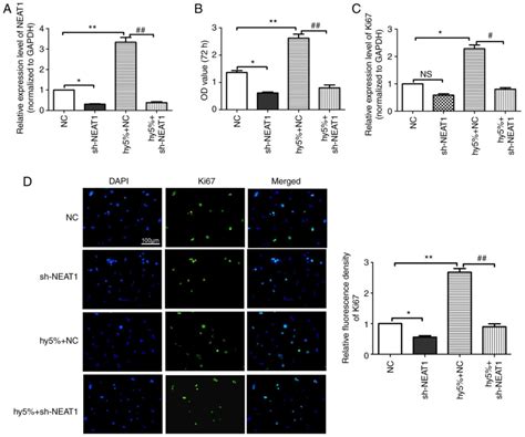 knockdown of lncrna‑neat1 expression inhibits hypoxia‑induced scar fibroblast proliferation
