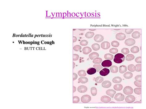 Ppt Morphologic And Distributive Leukocyte Disorders