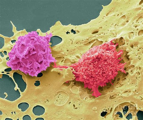 Natural Killer Cells And Cancer Cell Photograph By Steve Gschmeissner