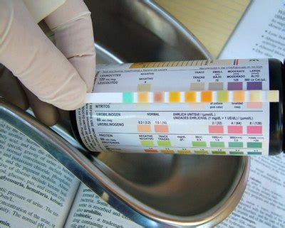 Protein & Blood in Your Urine | LIVESTRONG.COM