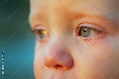 Cry Baby With Sky Blue Eyes Little Tender Baby Boy Crying Eye Drop