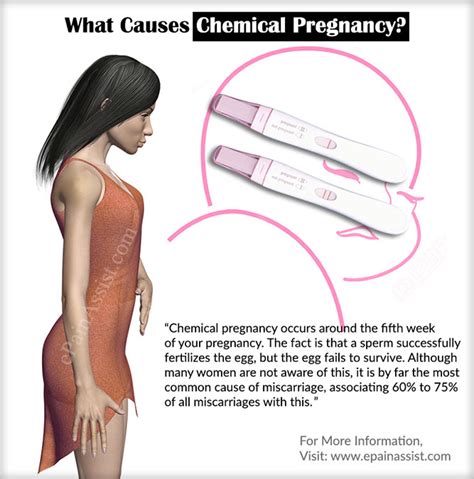 What Causes Chemical Pregnancy And Does It Require Treatment