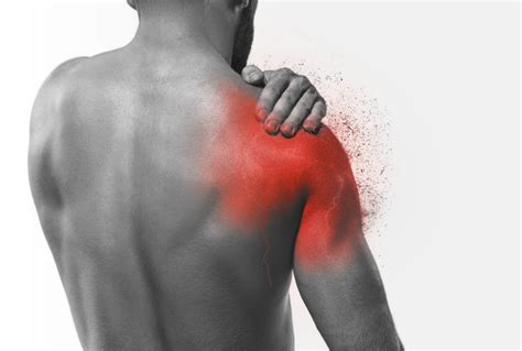 Pinched Nerve In Shoulder Causes And Treatment