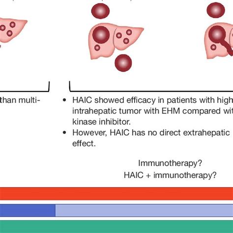 Advanced Hepatocellular Carcinoma Subdivision And Its Optimal Treatment