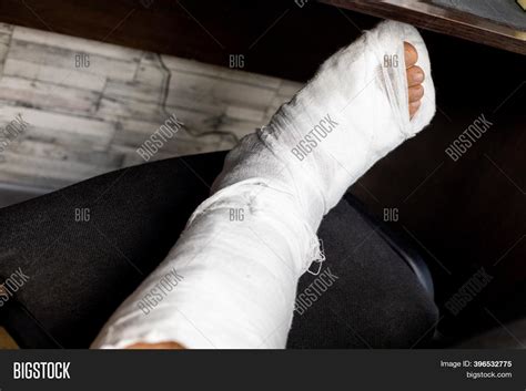 leg bandage fixed image and photo free trial bigstock